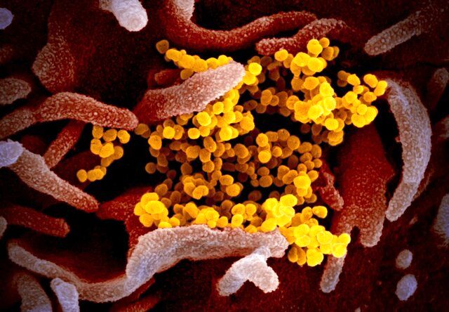 دوران کومون کرونا ویروس چقدر است؟/تا چه مدت افراد می توانند ناقل ویروس کرونا باشند؟