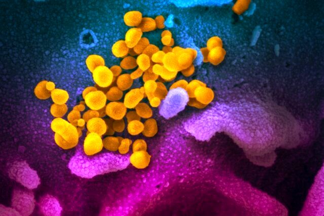 آزمایش کم هزینه تر کرونا ویروس در انتظار دریافت مجوز از انگلیس